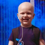 A Young Boy With A Nasogastric Tube And No Hair Due To Chemotherapy In Front Of A Blue Smoke Background